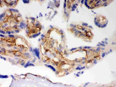 2 - Anti-BAK Picoband Antibody ABO12172