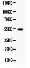 1 - Anti-Cyclin A1 Picoband Antibody ABO12173