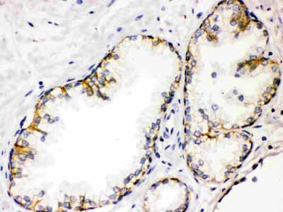 2 - Anti-CD46 Picoband Antibody ABO12174