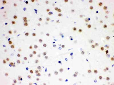 2 - Anti-Cdc25B Picoband Antibody ABO12176