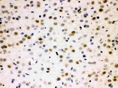 2 - Anti-Cdc25B Picoband Antibody ABO12176