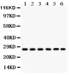 1 - Anti-CIB1 Picoband Antibody ABO12177