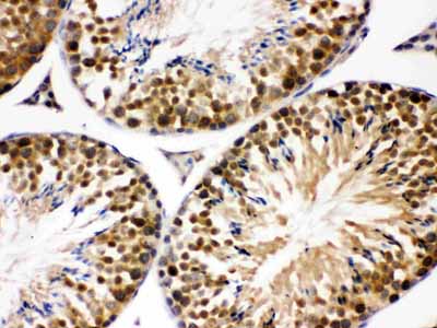 2 - Anti-JAB1 Picoband Antibody ABO12178