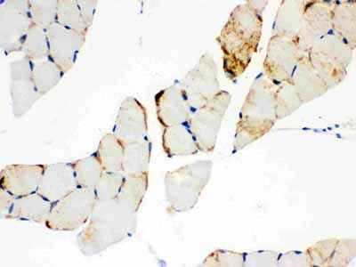 2 - Anti-CPT1B Picoband Antibody ABO12179