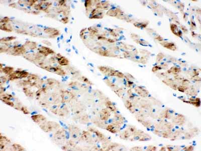 2 - Anti-CPT1B Picoband Antibody ABO12179