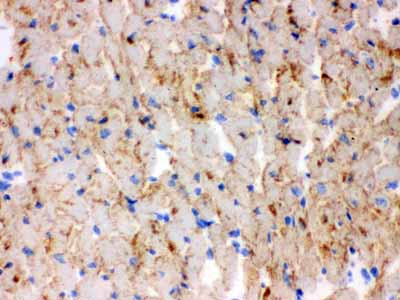 2 - Anti-CPT1B Picoband Antibody ABO12179