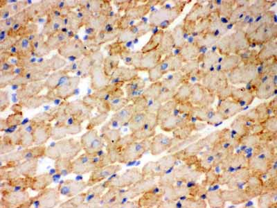 2 - Anti-CPT1B Picoband Antibody ABO12179
