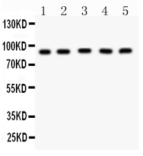 1 - Anti-CPT1B Picoband Antibody ABO12179