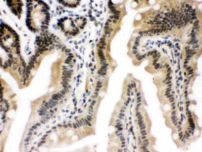 2 - Anti-CTCF Picoband Antibody ABO12181