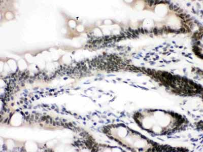 2 - Anti-CTCF Picoband Antibody ABO12181