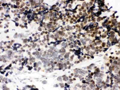 2 - Anti-CTCF Picoband Antibody ABO12181