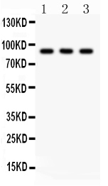 1 - Anti-CTCF Picoband Antibody ABO12181