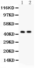 1 - Anti-Cystathionase Picoband Antibody ABO12182