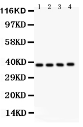 1 - Anti-PINX1 Picoband Antibody ABO12186
