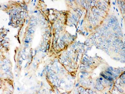 2 - Anti-PKLR Picoband Antibody ABO12187