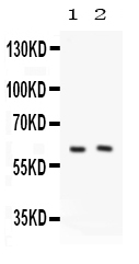 1 - Anti-PKLR Picoband Antibody ABO12187
