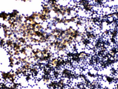 2 - Anti-PLK1 Picoband Antibody ABO12188