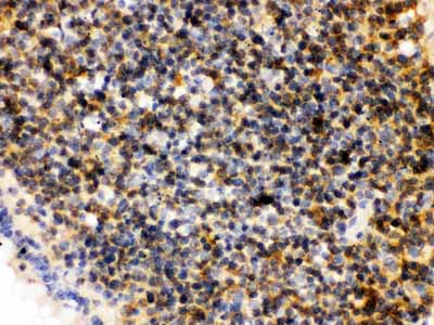 2 - Anti-PLK1 Picoband Antibody ABO12188