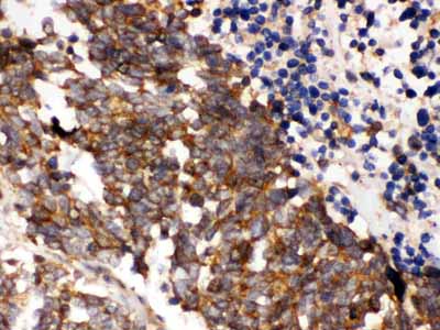 2 - Anti-PLK1 Picoband Antibody ABO12188