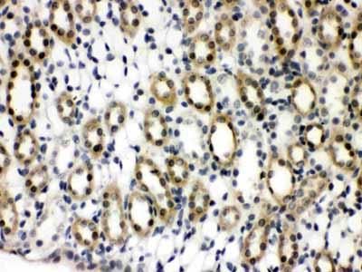 2 - Anti-TCPTP Picoband Antibody ABO12189