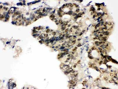 2 - Anti-TCPTP Picoband Antibody ABO12189