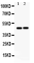 1 - Anti-TCPTP Picoband Antibody ABO12189