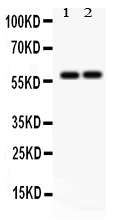 1 - Anti-SCARB1 Picoband Antibody ABO12190
