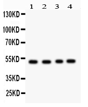 1 - Anti-SOCS4 Picoband Antibody ABO12194