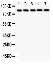 1 - Anti-SOX5 Picoband Antibody ABO12195