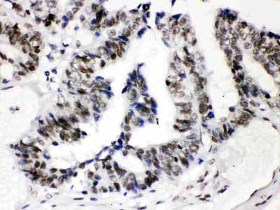 2 - Anti-SP3 Picoband Antibody ABO12196