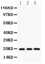 1 - Anti-SFRS3 Picoband Antibody ABO12197