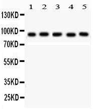 1 - Anti-STAT5b Picoband Antibody ABO12200