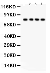 1 - Anti-sTNFsR II Antibody ABO12202