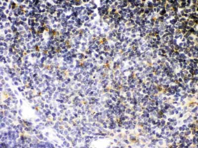 2 - Anti-sTNFsR II Antibody ABO12203