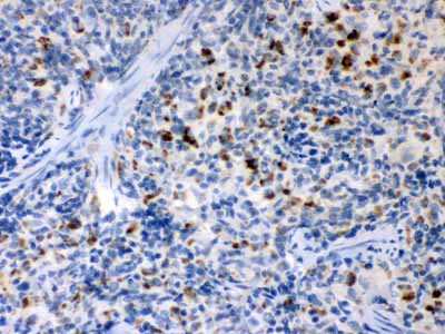 2 - Anti-sTNFsR II Antibody ABO12203