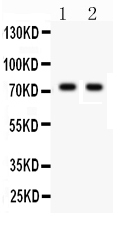 1 - Anti-sTNFsR II Antibody ABO12203