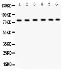 1 - Anti-TRPV5 Picoband Antibody ABO12205