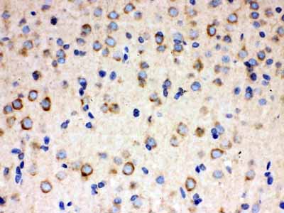 2 - Anti-ULK3 Picoband Antibody ABO12206