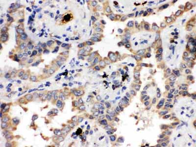 2 - Anti-ULK3 Picoband Antibody ABO12206