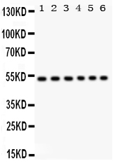 1 - Anti-ULK3 Picoband Antibody ABO12206