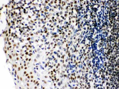 2 - Anti-Ku70 Picoband Antibody ABO12207