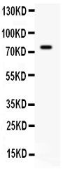 1 - Anti-IL-7 Antibody ABO12208