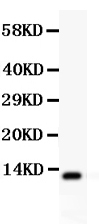 1 - Anti-TFF1 Picoband Antibody ABO12209
