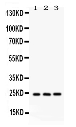 1 - Anti-BAG2 Picoband Antibody ABO12211