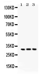 1 - Anti-Bcl10 Picoband Antibody ABO12212