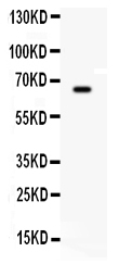 1 - Anti-BCHE Picoband Antibody ABO12213