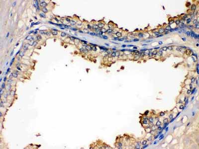 2 - Anti-BMPR1B Picoband Antibody ABO12215