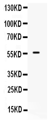 1 - Anti-BMPR1B Picoband Antibody ABO12215