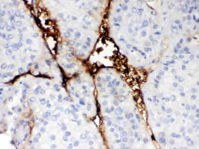 2 - Anti-CA1 Picoband Antibody ABO12216