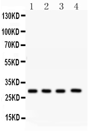 1 - Anti-CA1 Picoband Antibody ABO12216